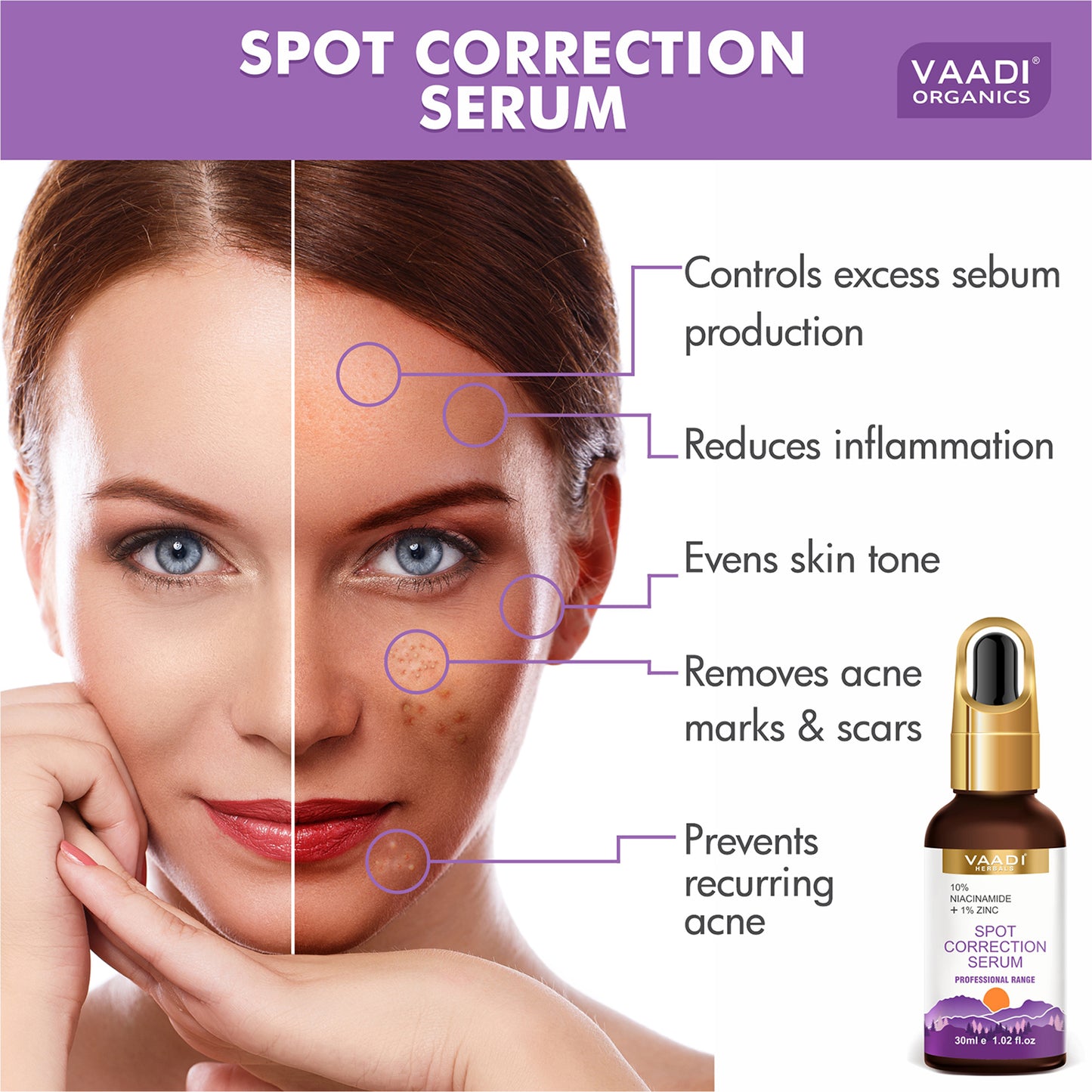 Organic Spot Correction Serum With 10 % Niacinamide & 1% Zinc (30 ml)