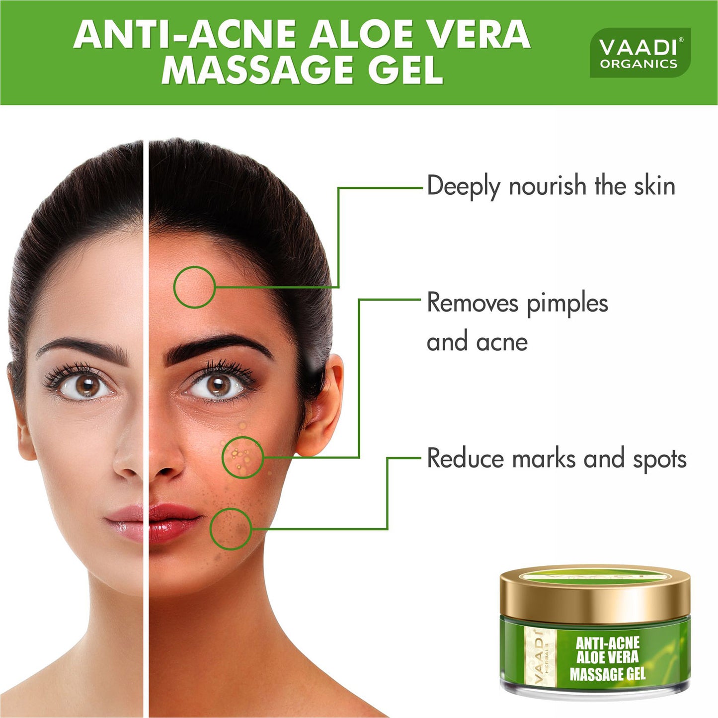 Anti Acne Aloe Vera Massage Gel - Removes Skin Impurities - Keeps Skin Soft (50 gms/ 2 oz)