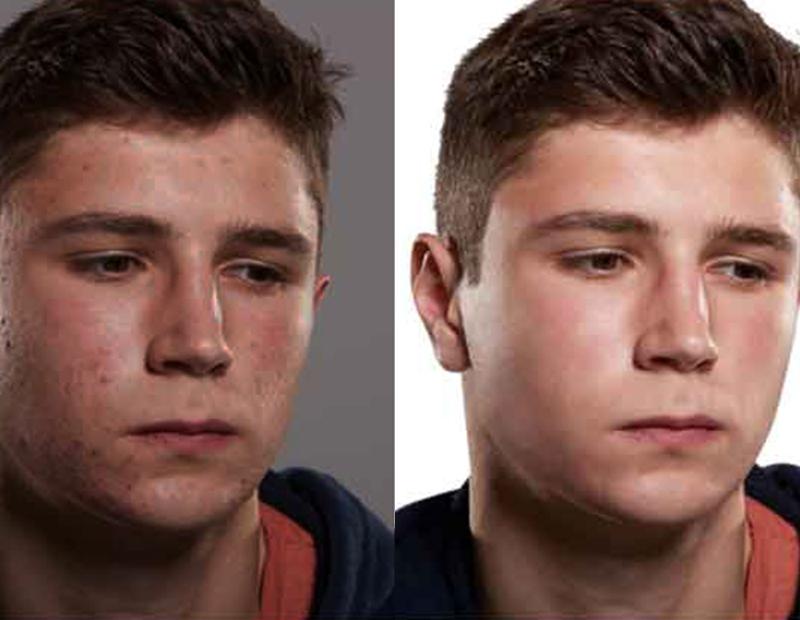 SKIN BRIGHTENING SET - GET VISIBLY FAIR SKIN IN JUST 3 WEEKS