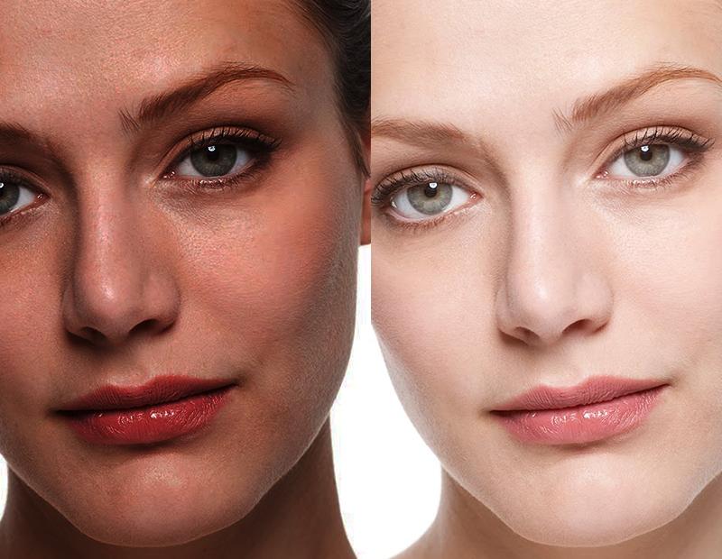 SKIN BRIGHTENING SET - GET VISIBLY FAIR SKIN IN JUST 3 WEEKS