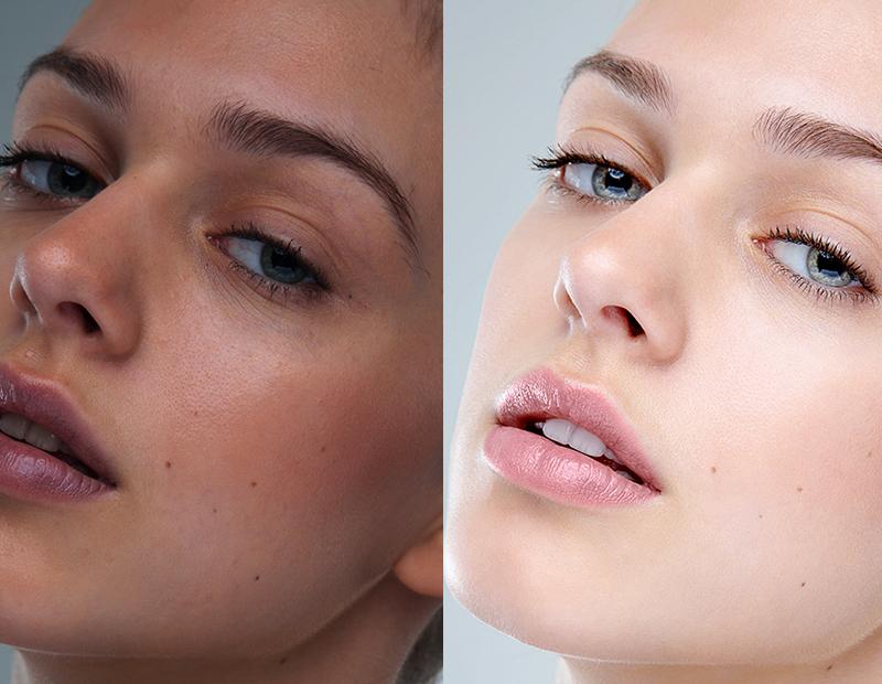 SKIN BRIGHTENING SET - GET VISIBLY FAIR SKIN IN JUST 3 WEEKS