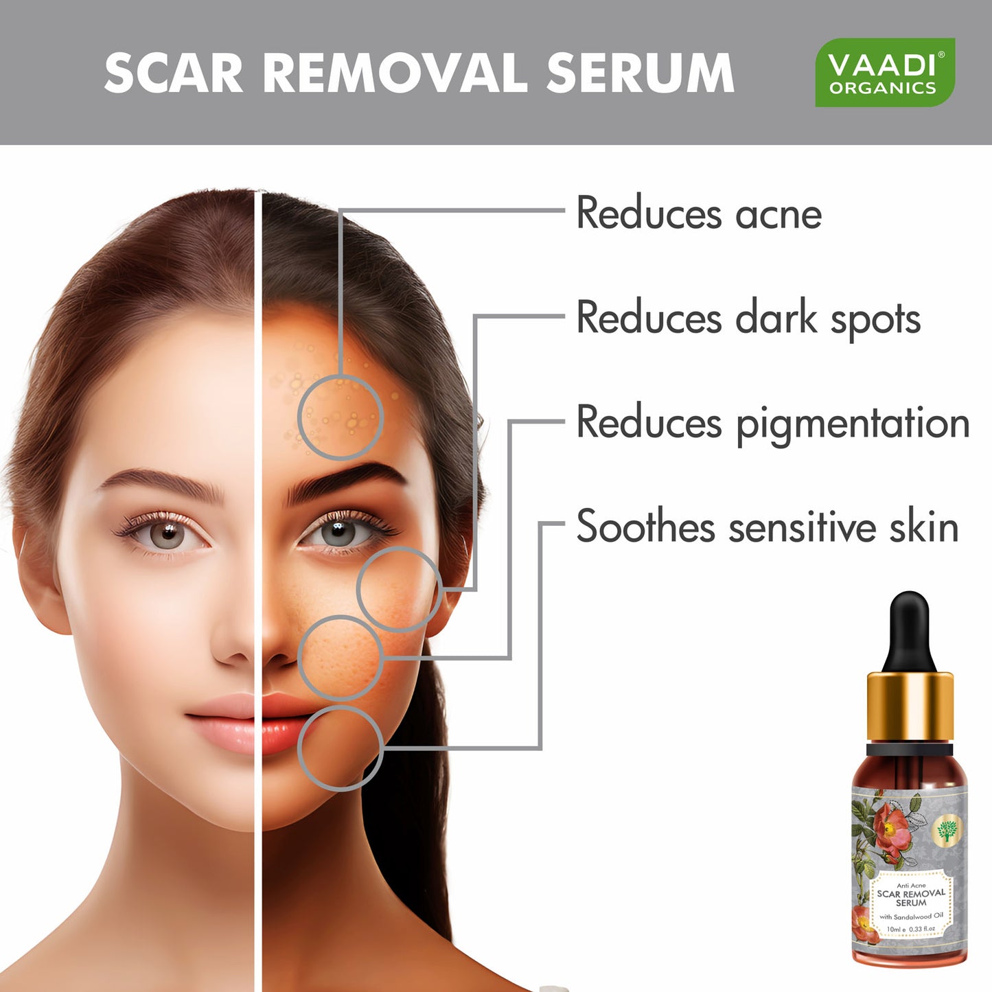 Pack of 2 Organic Scar Removal Serum - Reduces Acne, Dark Spots & Pigmentation