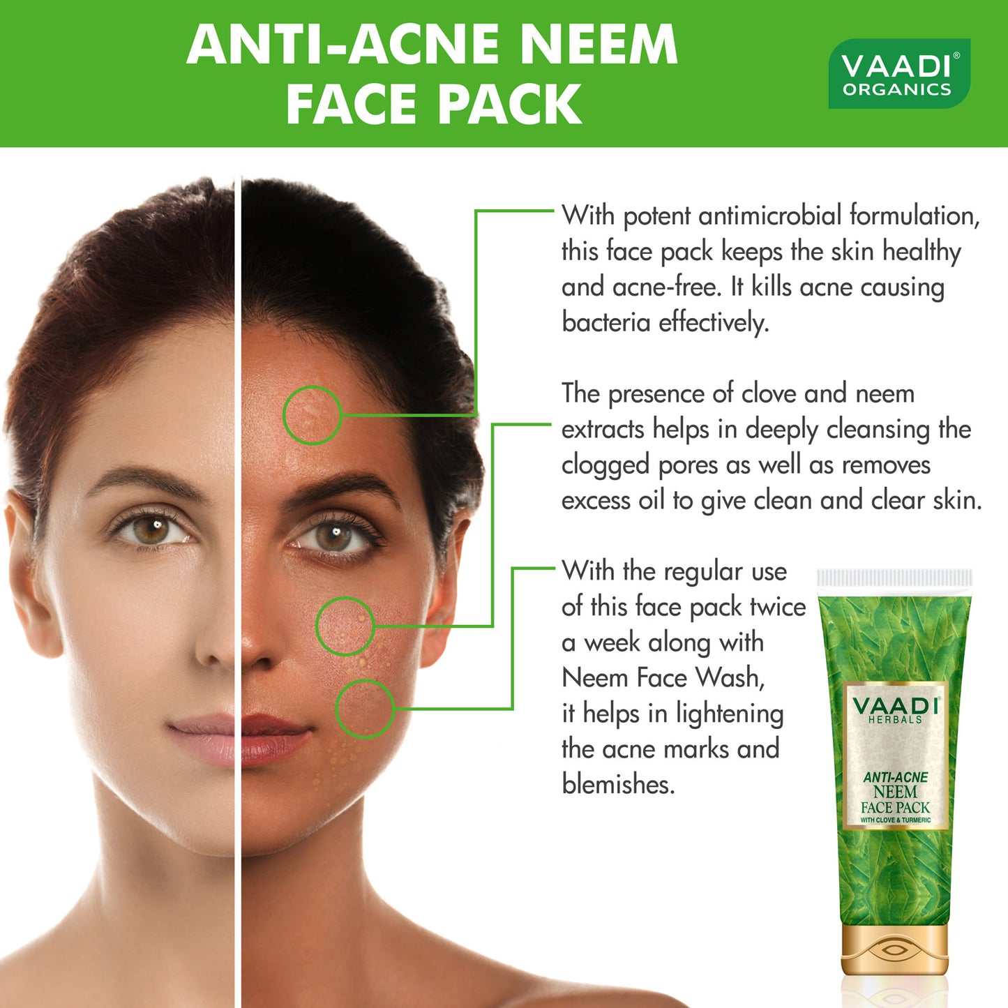 Organic Neem Face Pack with Clove & Turmeric - Removes Acne and Pigmentation Marks - Clears Impurities and Soothes Skin (2 x 120 gms / 4.3 oz)