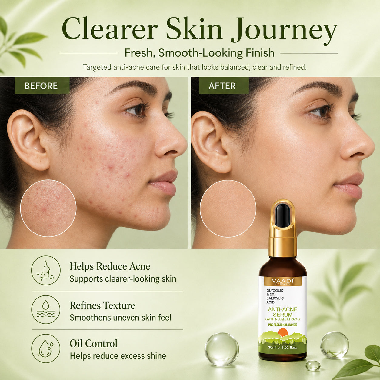Anti-Acne Serum With Glycolic & 2% Salicylic Acid (30 ml)
