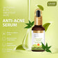 Organic Anti-Acne Serum With Glycolic & 2% Salicylic Acid (30 ml)