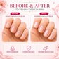 Nail & Cuticle Oil with Jojoba Oil - Heals Redness & Pain - Strengthens Thin & Brittle Nails (10 ml/ 0.4 fl oz)
